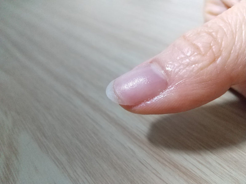 爪が薄い状態の指先